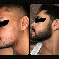 ریش حرفه‌ای