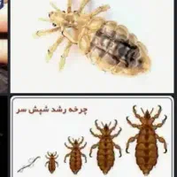 پودرشپش