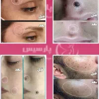 پلاسماوفیان مزو نیدل و کرم پودر دائم