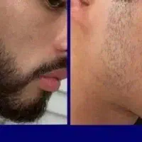 معجزه پرپشتی ریش