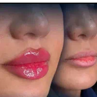 کلینیک زیبایی فیلربوتاکس آنزیم