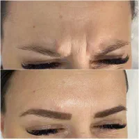 آموزش بوتاکس و فیلر و تزریق چربی و جراحی زنان