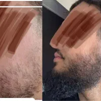 با خیال راحت تغییر کن