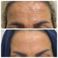 معروف ترین بیوممتیک ایران