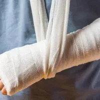 شکسته بندی