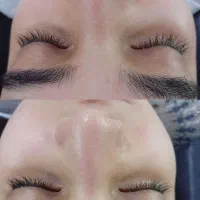 کاشت مژه موقت پاکسازی صورت