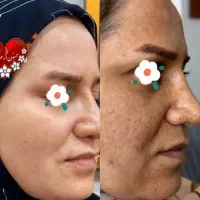 سفید و برفی شو