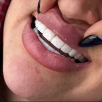 کلینیک دندان پزشکی با جشنواره تابستانی ایلام