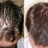 این اولین و اخرین کاریه که برای موهات میکنی