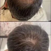 از اینه فرار نکن