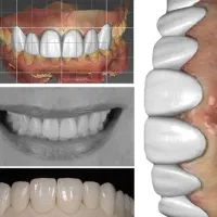 استخدام واموزش طراحی دندان اگزوکد دندان سازی