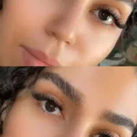 کاشت مژه هیدن حرفه ای