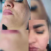 مرکز لیزر و زیبایی الفا