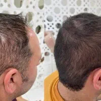 نتیجه واقعی درمانجو ها