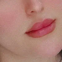 ژل وبوتاکس
