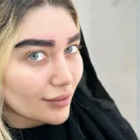 میکرو کاشت ابرو به دو روش روز دنیا