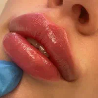 پکیج‌های ویژه خدمات زیبایی تا پایان ماه