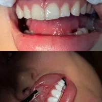 دندان پزشکی باقیمت های باورنکردنی (همراه با ضمانت)