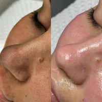 پاکسازی پوست