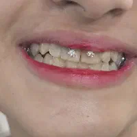 پرسینگ|خدمات آرایشگری و زیبایی|اسلام‌شهر, شهرک مصطفی خمینی|دیوار