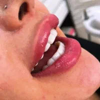 کامپوزیت با ضمانت ۵ سال فقط ۹/۸۰۰