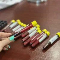 پی آر پی مزو مزوژل ۱/۲۰۰