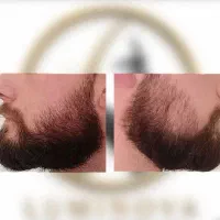 خداحافظی باظاهر کم تراکم ریش