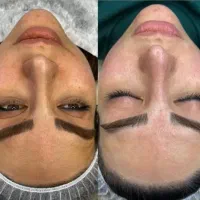 فیشال تخصصی و پاکسازی عمیق