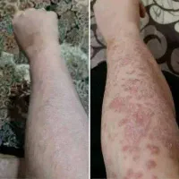 سلامتی تو به خودت هدیه بده