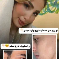 رویش ریش سبیل