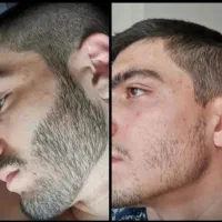 خوشگل کننده طبیعی آقایون