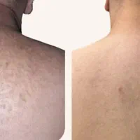 تیرگی هاتو از بین ببر