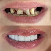 تخفیف دندانپزشکی