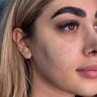 پیرسینگ مطبی گوش غضروف،گوشواره کودک، میکرودرمال