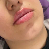 ژل لب در زعفرانیه فقط ۱/۵۰۰