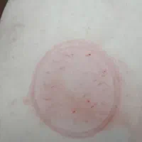 باد کش