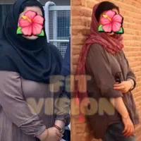 اسلیو طبیعی (لاغری بدون جراحی)