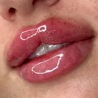 فیلر/ژل لب صورت کاشت مژه روباهی/کایلی..|خدمات آرایشگری و زیبایی|پاکدشت, |دیوار