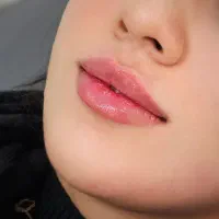 تزریق ژل وبوتاکس وجوانسازی