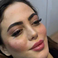 خدمات ژل بوتاکس مزو فیلر انزیم بوتاکس