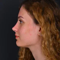 جشنواره زمستانی جراحی زیبایی