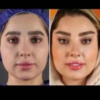 استخدام لیدر برای مطب زیبایی