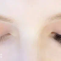 کاشت مژه والیوم
