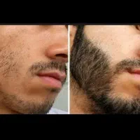 از ریش تا مو رو تضمینی دربیار