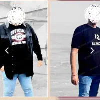 اسلیو معده اقساط فوق تخصص جراحی لاپارسکوپی بای پس