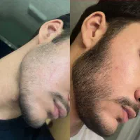 معجزه ریش هات اینجا است