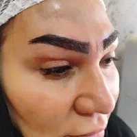 کاشت ابرو و‌مو‌ و ریش