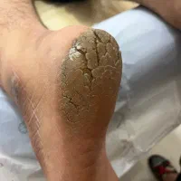 اموزش ماساژ فنی و‌حرفه ای