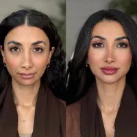 جشنواره تابستانه فیلر بوتاکس PRP لیزر لیفت نخ