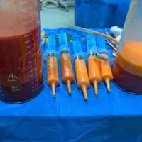 این اگهی مخصوص اقایان /ژنیکو ماستی،لیپو،تزریق